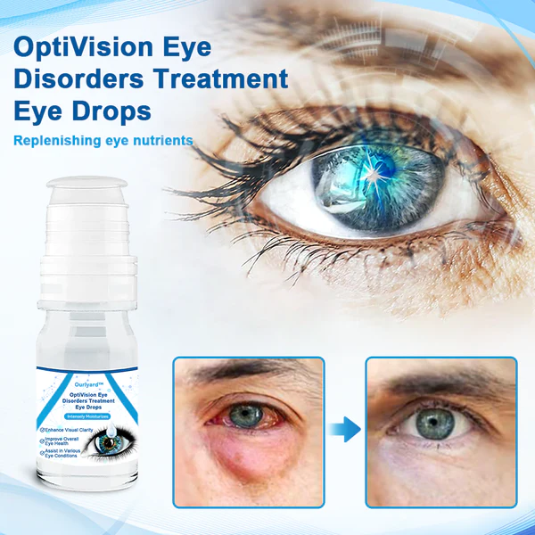 Ourlyard™ OptiVision Eye Disorders Treatment Eye Drops - Image 7