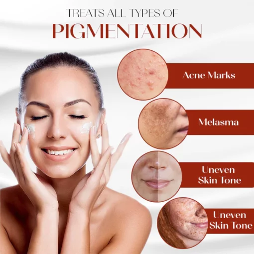 Oveallgo™ ProX Dark Spot Corrector Cream - Ofbylding 7