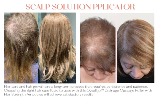 Oveallgo™ Rullo di massaggio drenante con ampolle per la forza dei capelli - Image 8