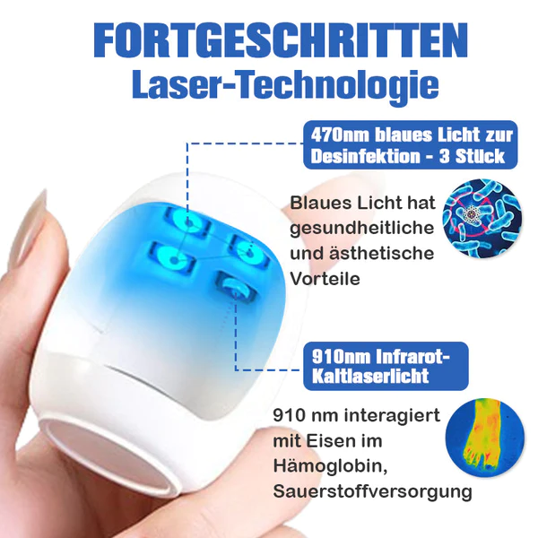 Furzero Nagelpilzreinigung Laser Linderungsger
