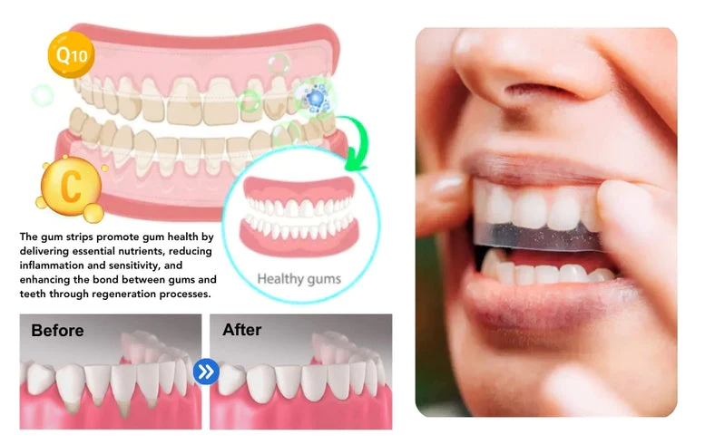 Fivfivgo Gum Repair Strips