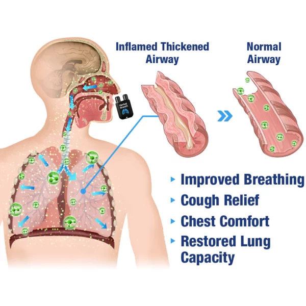GFOUK HerbalBreathe Respiratory Cleansing Aerosolizer