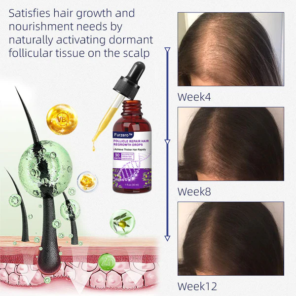Furzero Follicle Repair Hair Regrowth Drops