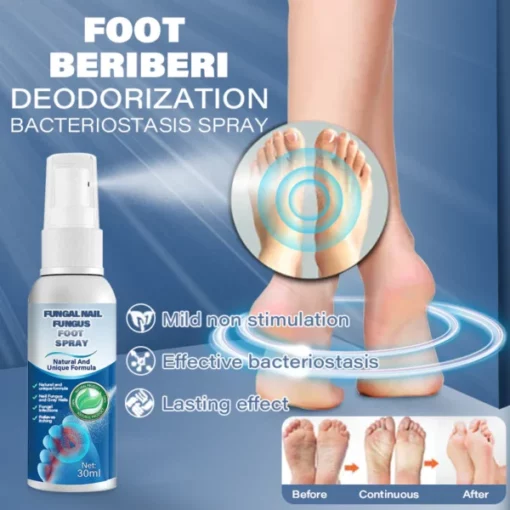 Furzero™ Nail Fungus Foot Spray