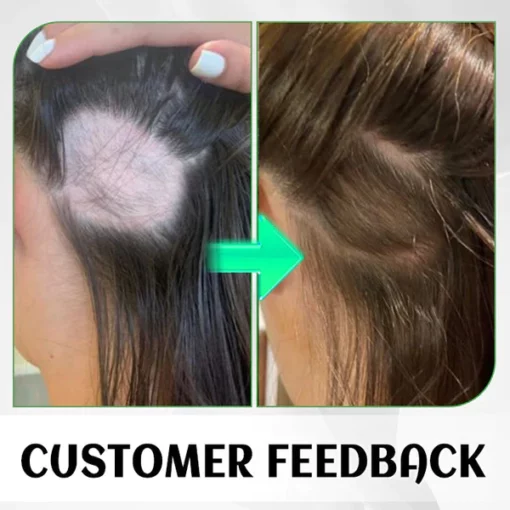 Fivfivgo FolliHerb Haarwachstumsspray