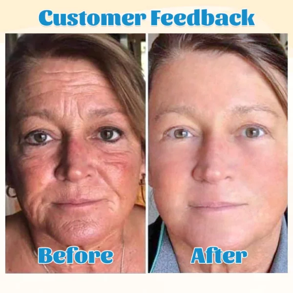 Furzero Hyalu B5 Pure Anti-Aging Face Serum