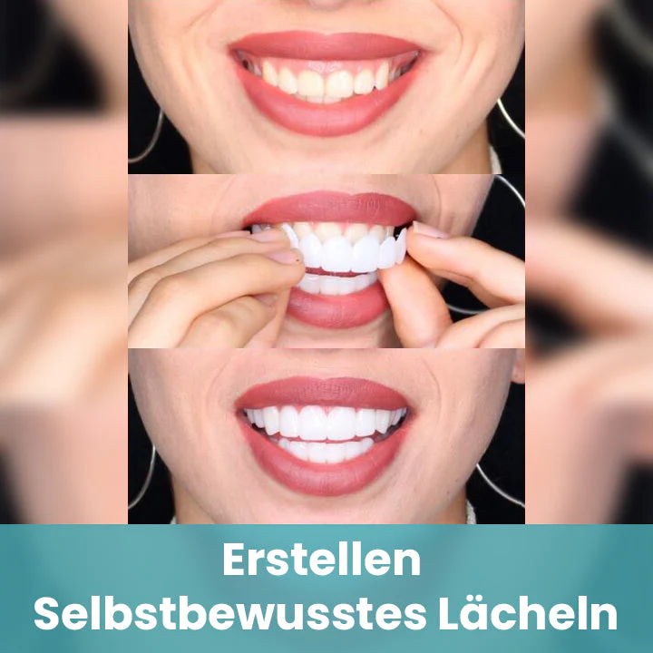 Ceoerty™ QuickSmile Verstellbare Schnappprothese - Image 6