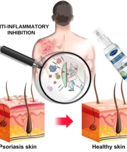 Alternative view of Fivfivgo™ Psoriasis-Behandlungsspray
