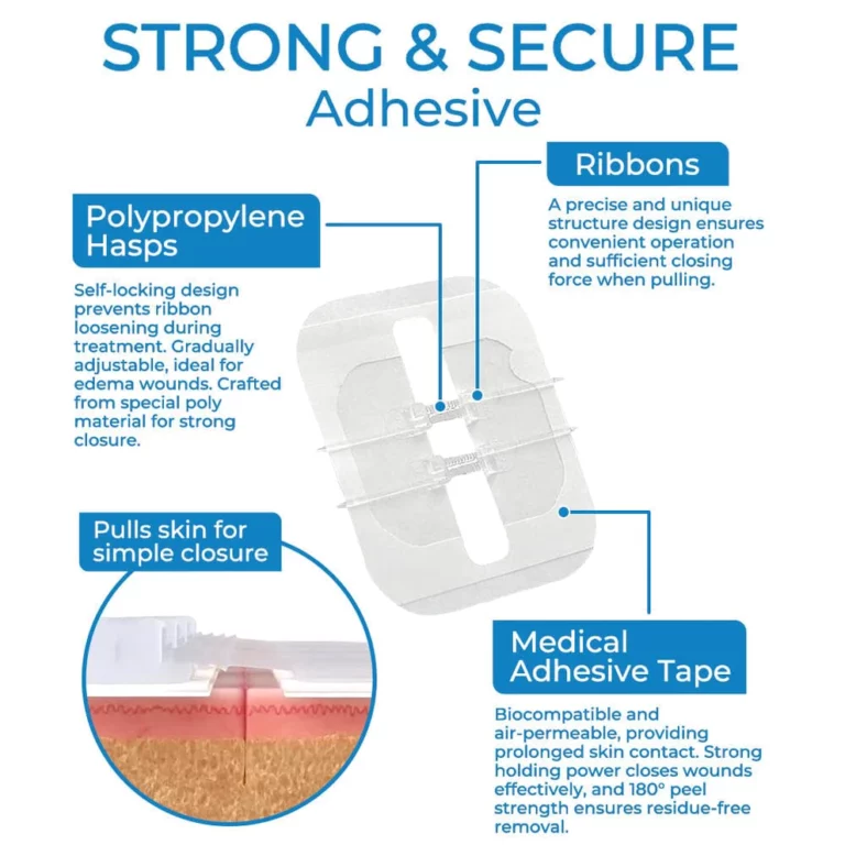 GFOUK StitchClosure Device