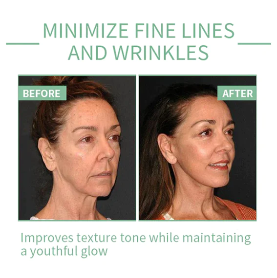Fivfivgo Collagen Boost Anti-Aging Serum For Remove 97% Deep Wrinkles & Dark Spots