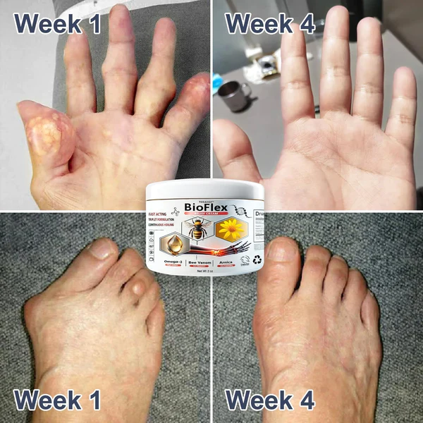 TiworldNew Zealand Bee Venom Joint and Bone Therapy Advanced Cream