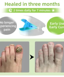 Alternative view of Fivfivgo™ Nagelpilz-Lasertherapiegerät Max