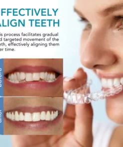 Alternative view of Fivfivgo™ Kieferorthopädie Begradigung Guard