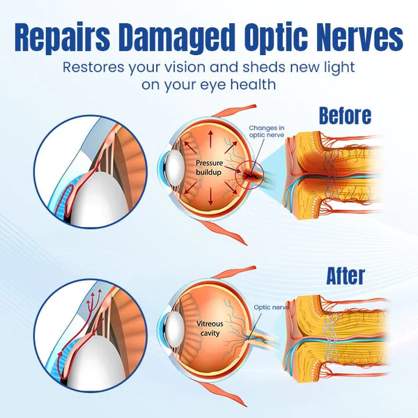 Ceoerty OptiRenew Eye Treatment Drops