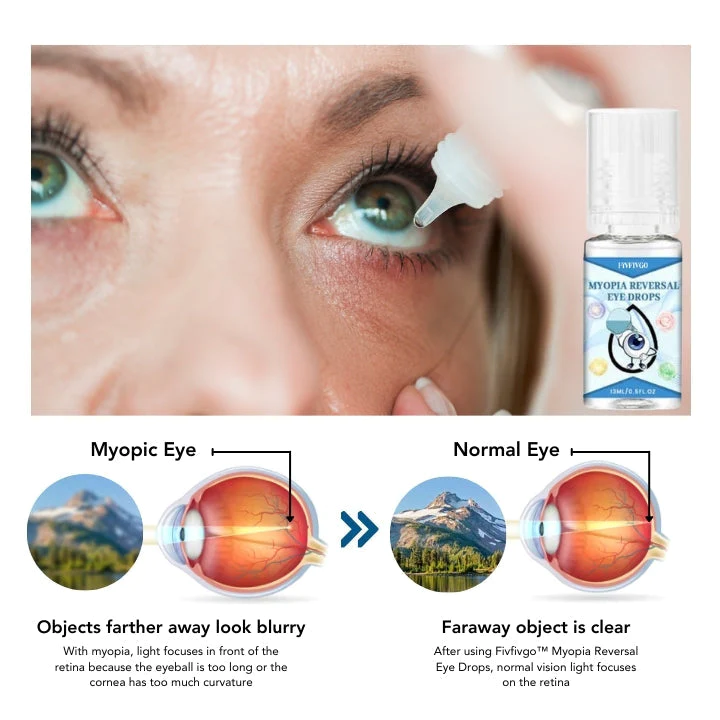 Fivfivgo Myopie Reversal Augentropfen