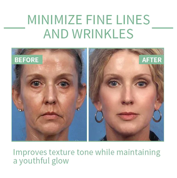Fivfivgo Collagen Boost Anti-Aging Serum For Remove 97% Deep Wrinkles & Dark Spots