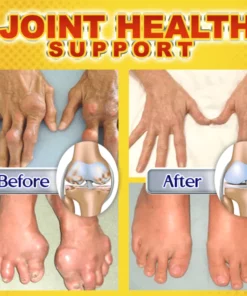 Alternative view of Seurico™ Joint & Bone Therapy Bee Venom Treatment Gel