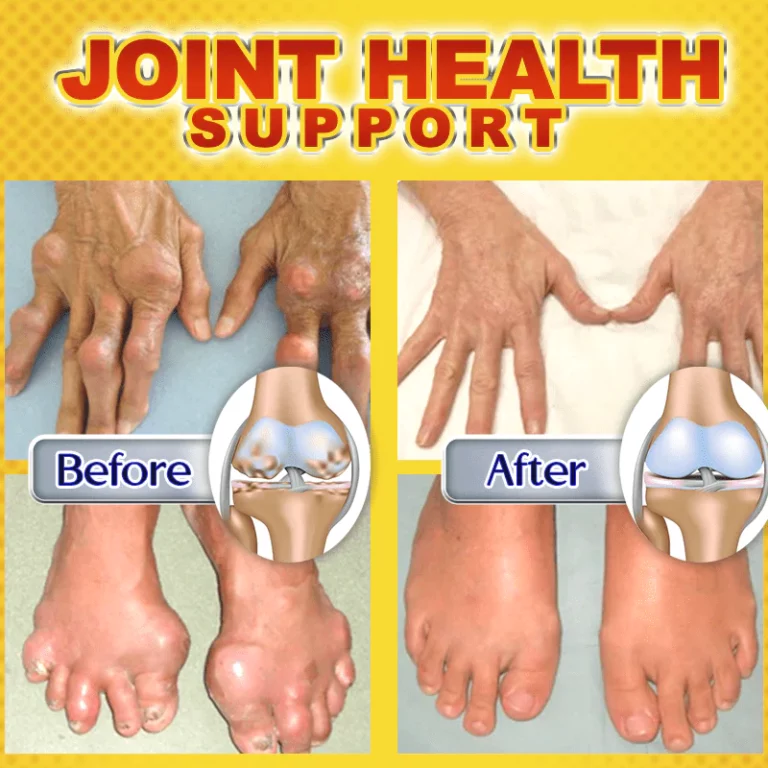 Seurico Joint & Bone Therapy Bee Venom Treatment Gel