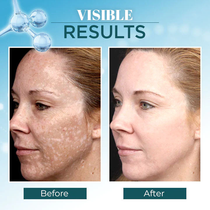 Lanthome Triple-Active Brightening Dark Spot Remover