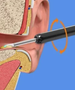 1080P Ear Wax Removal Camera