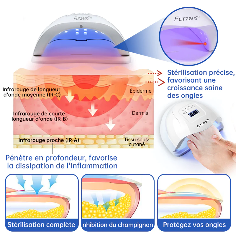 Furzero Le Dispositif de Thrapie Laser Antifongique