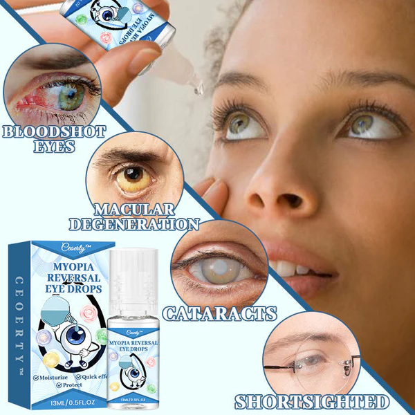 Ceoerty Myopia Reversal Eye Drops