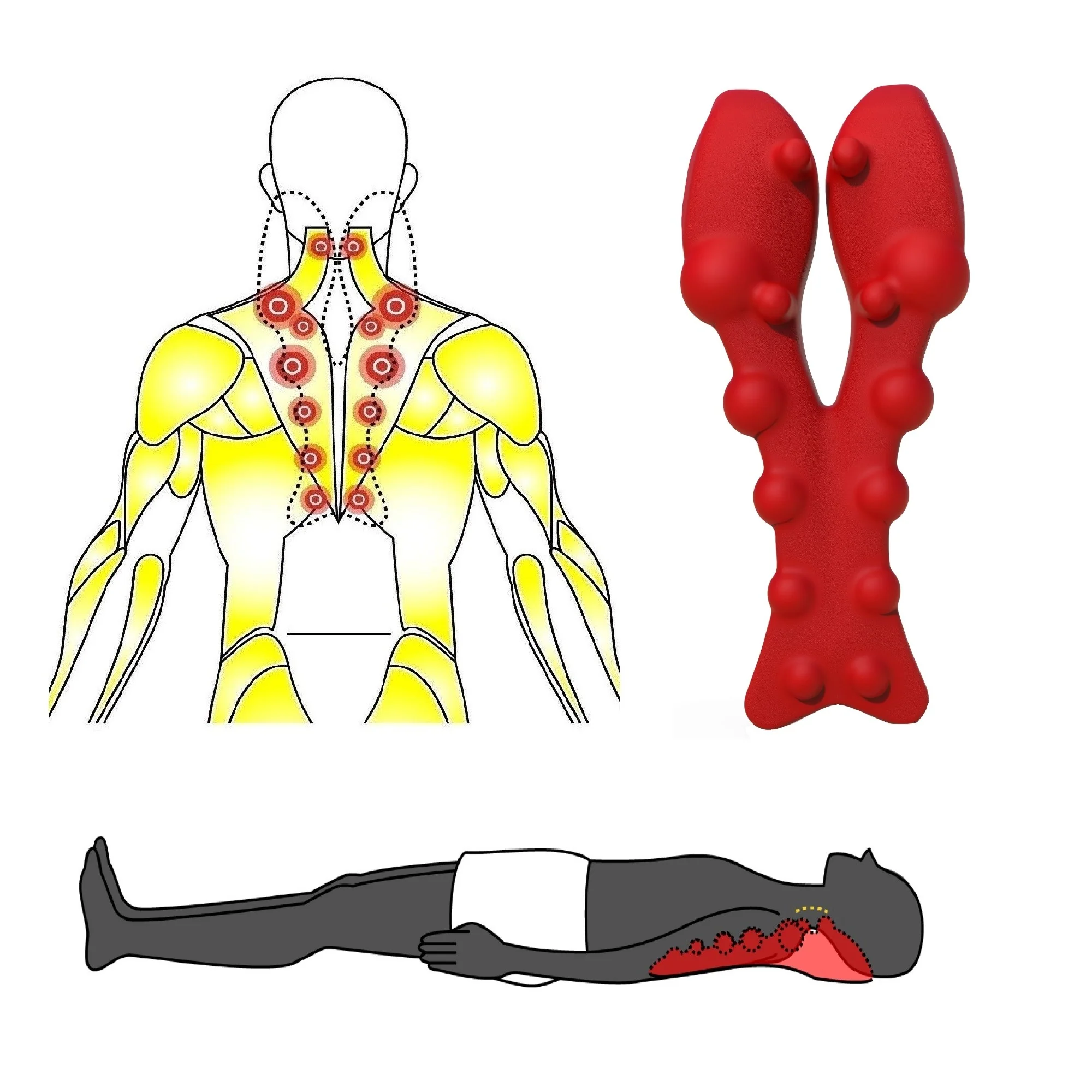 Littlemum Trapezius Trigger Point Massager