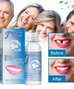 Alternative view of Temporary Tooth Sculptor Repair Kit