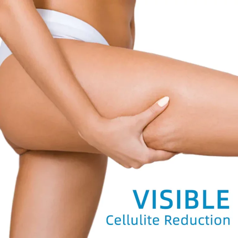 BeYou Beauty Women Collagen Lifting Body Oil - Image 9