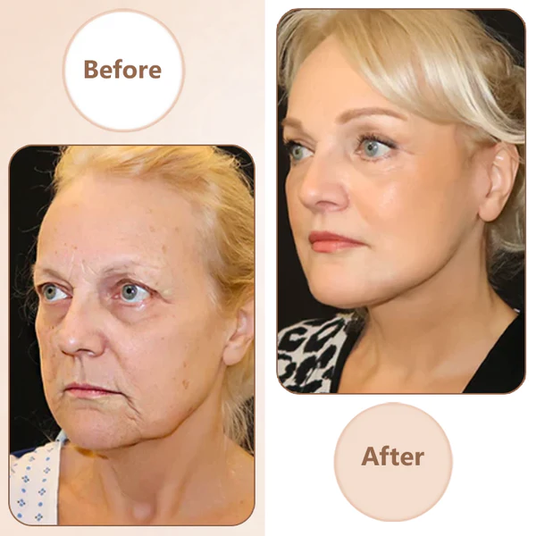 Oveallgo™ FirmLuxe Multi-Power Firming Magic Cream - Image 12