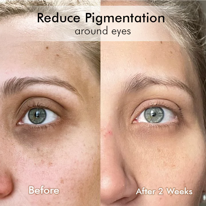 Oveallgo™ Retinol Intense Advanced Triple Action Eye Cream - Image 11