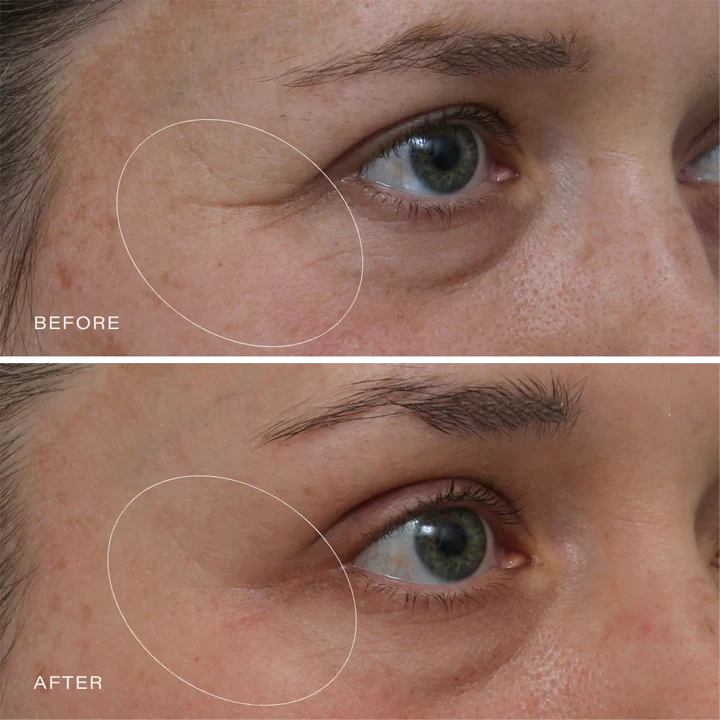 Oveallgo™ Retinol Intense Advanced Triple Action Eye Cream - Image 10