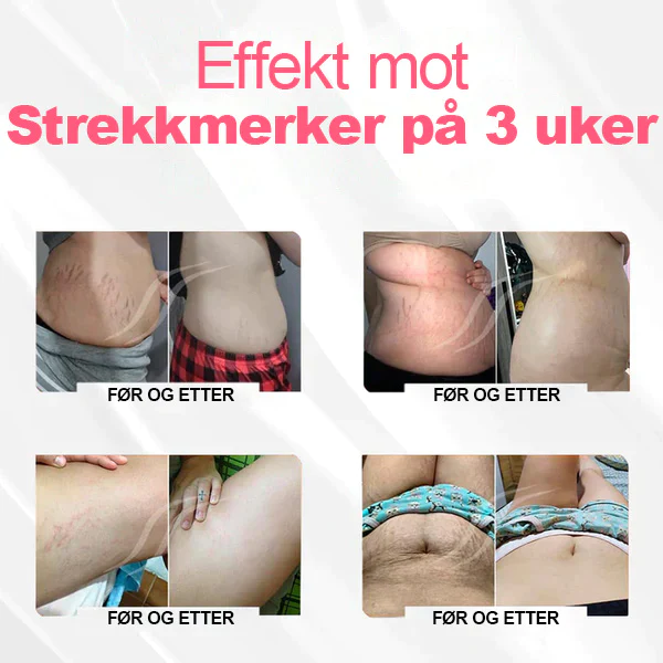 ANYIDEA Magnetisk Nano Ion Fettforbrenning Magekontroll Detox Shaper
