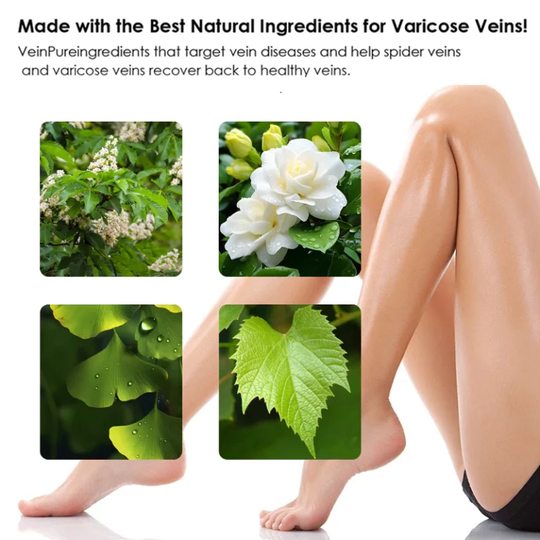 Seurico™ Vein Varicose Relief Spray - Image 5