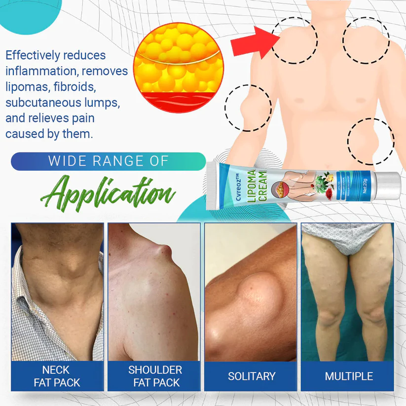 Cvreoz Bee Venom Lipomas Elimination Treatment Spray - Image 7