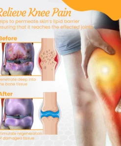 Alternative view of Fivfivgo™ NZ Bienengift Behandlungsgel