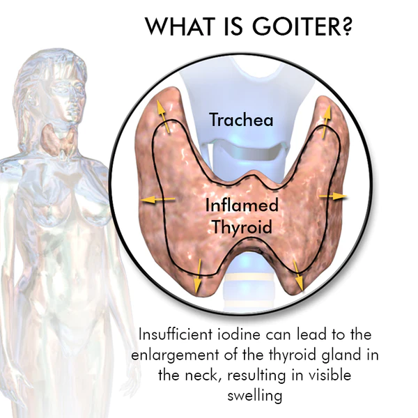 Oveallgo™ Goiterless Neck Skin Firming Serum - Image 5