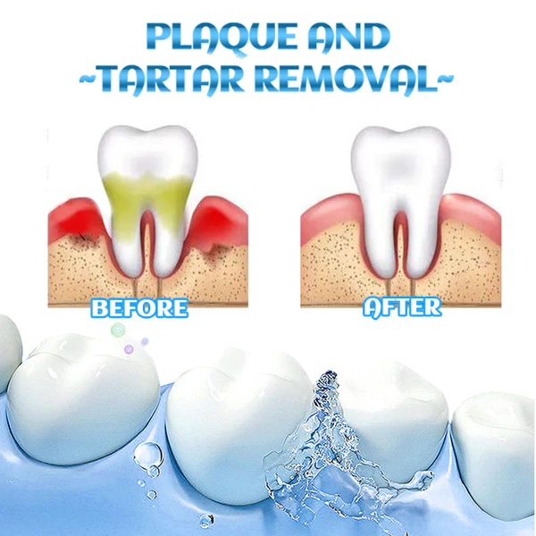 🦷Hudros™ FreshTooth360° Mouthwash- 🦷Deep Cleansing Oral🦷 - Image 3