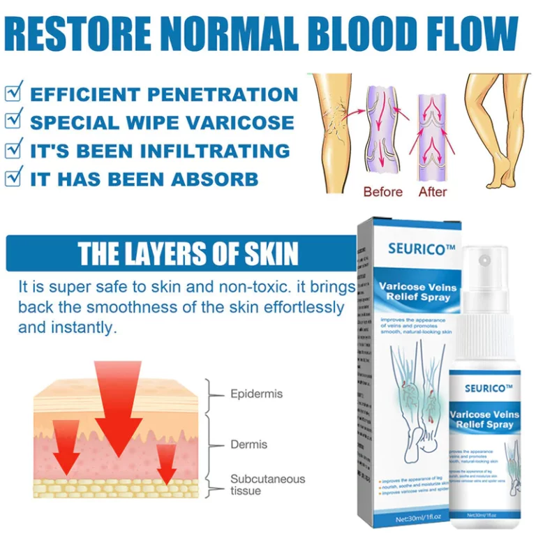 Seurico™ Vein Varicose Relief Spray - Image 3