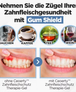 Ceoerty™ Zahnfleischschutz Therapie-Gel