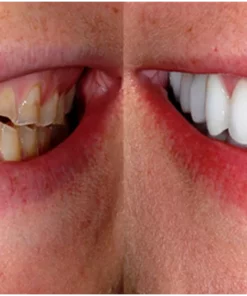 Alternative view of Furzero™ Herbal Brightening Oral Repair Foam