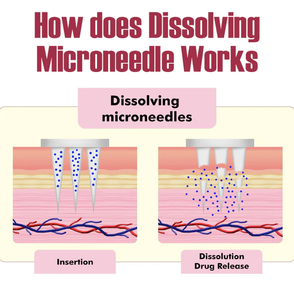 ATTDX Crystal Dissolving Microneedle Eye Patches - Image 3