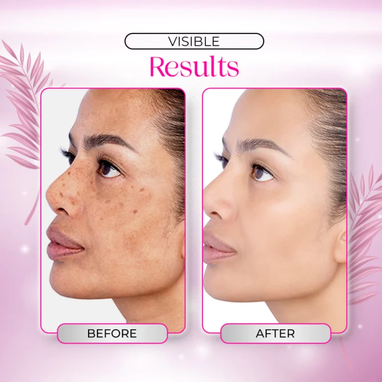 Dr.Rashel Niacinamide Whitening Day Cream