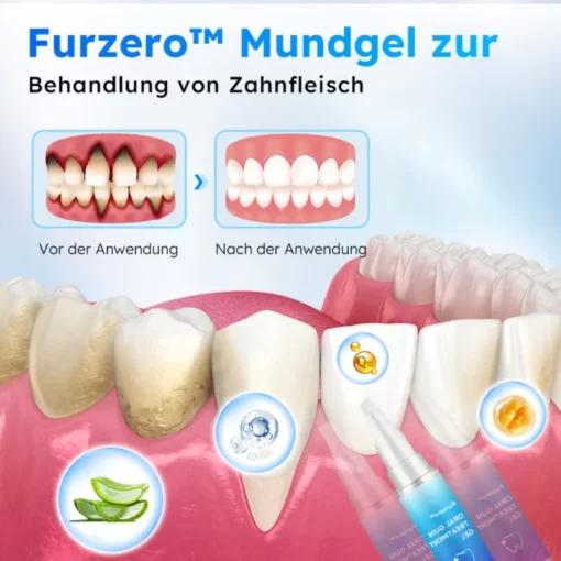 Hudros™ Oral Gel zur Zahnfleischbehandlung