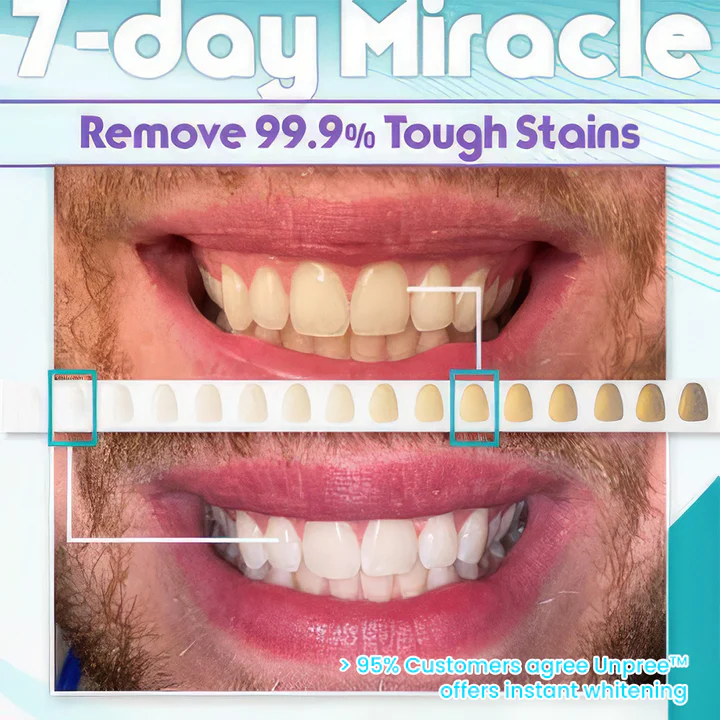 UNPREE™ NEW V34 Toothpaste Purple Color Corrector - Image 7