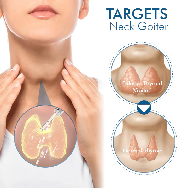 Oveallgo™ Goiterless Neck Skin Firming Serum - Image 10