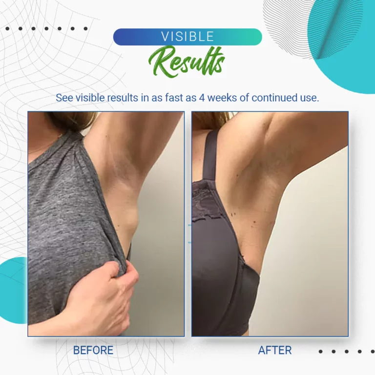 Uachtar toirt air falbh KISSHI ™ Lipoma - Ìomhaigh 9