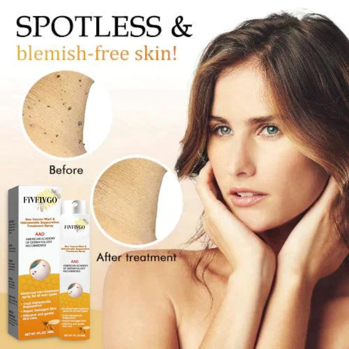 Fivfivgo™ Warze und Tags Entfernungsbehandlungsspray - Image 3