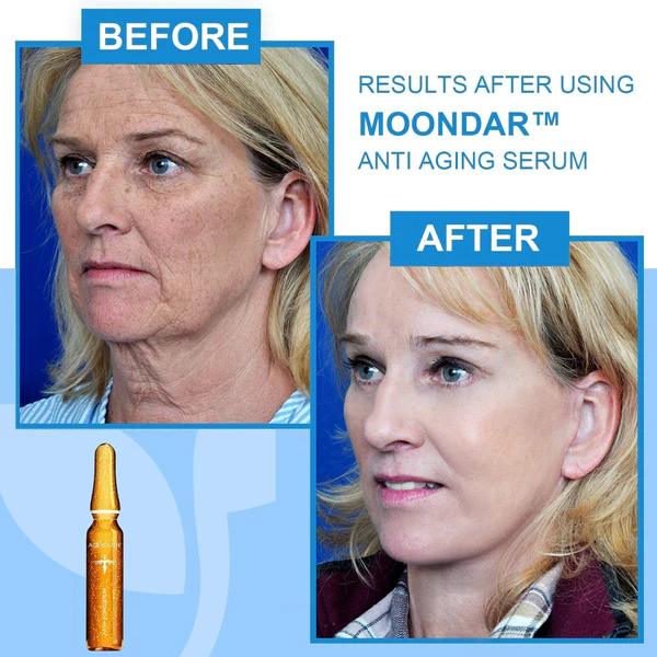 MOONDAR™ AgeYouth Anti-Aging Repair Serum - Image 5