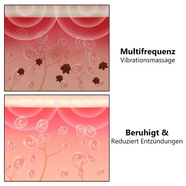 Fivfivgo RespiRevive EMS Nasaltherapie-Instrument